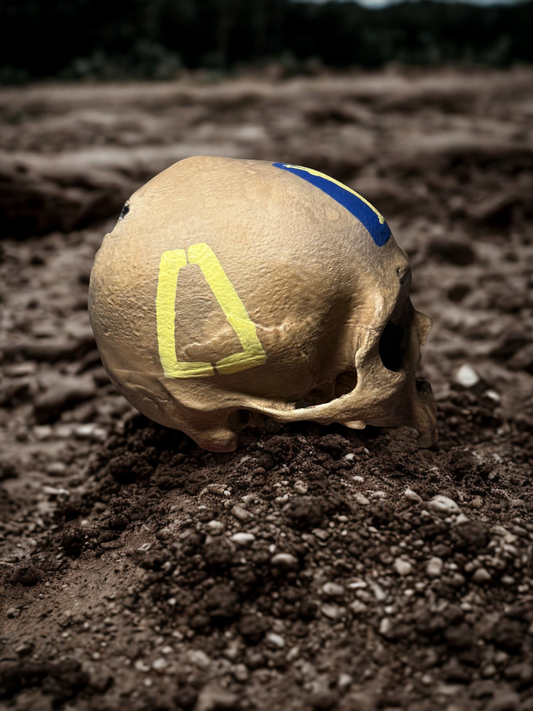 77th Infantry Skull